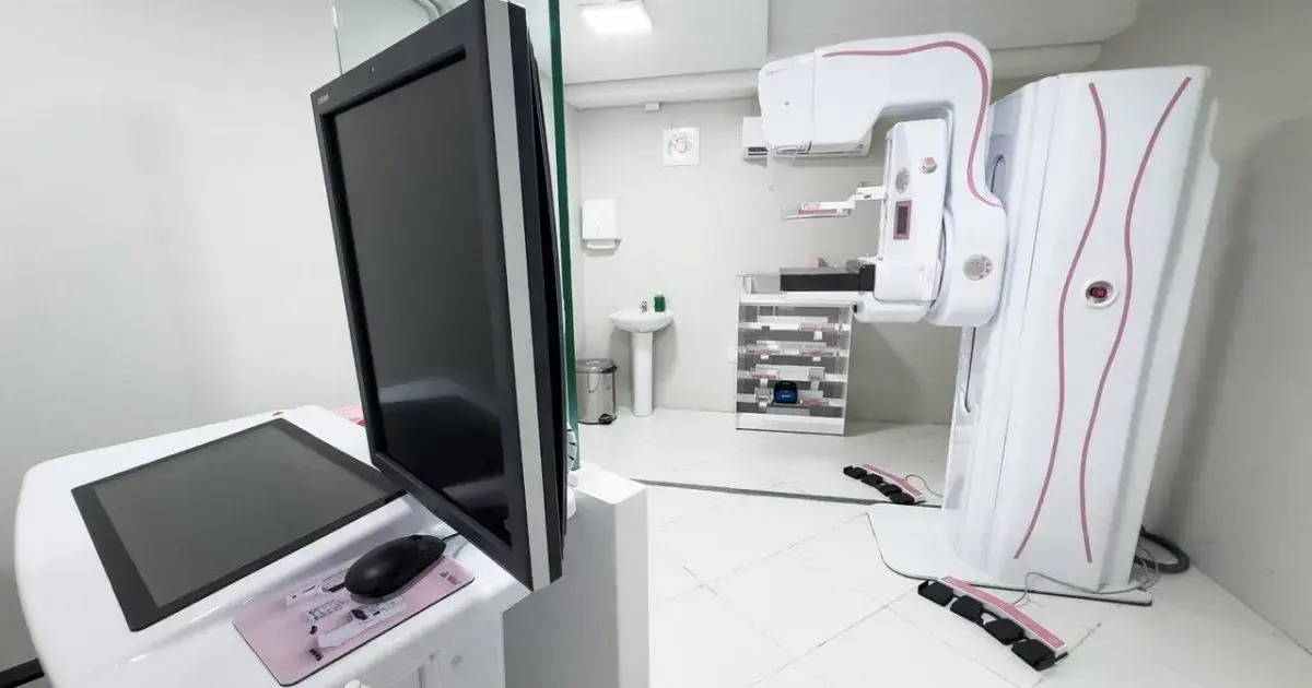 Mamógrafo moderno em ambiente clínico, com tela de computador e equipamentos organizados ao fundo.